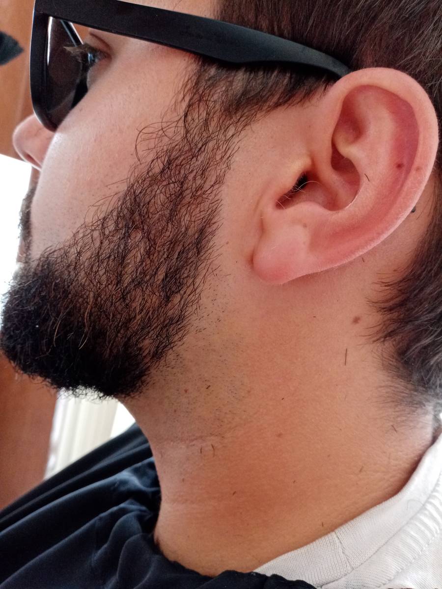 barbe